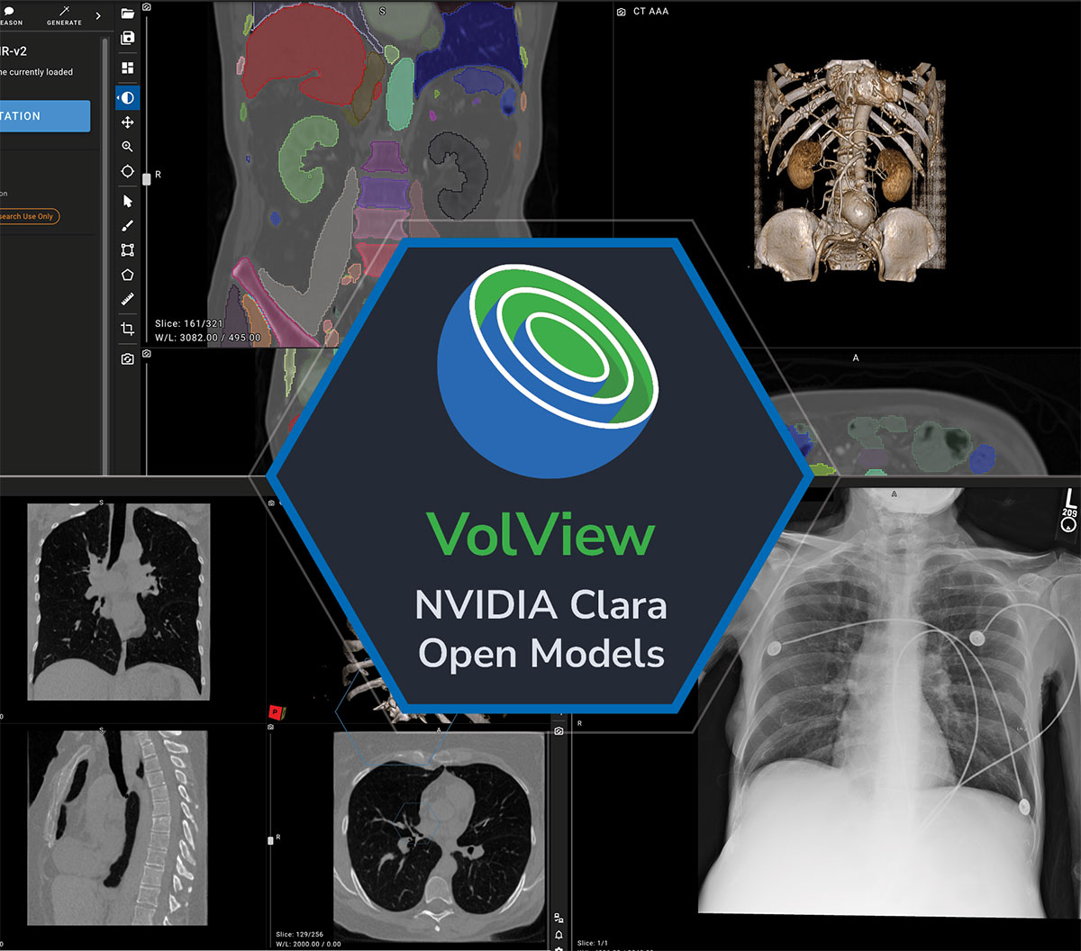 VolView logo. NVIDIA Clara Open Models