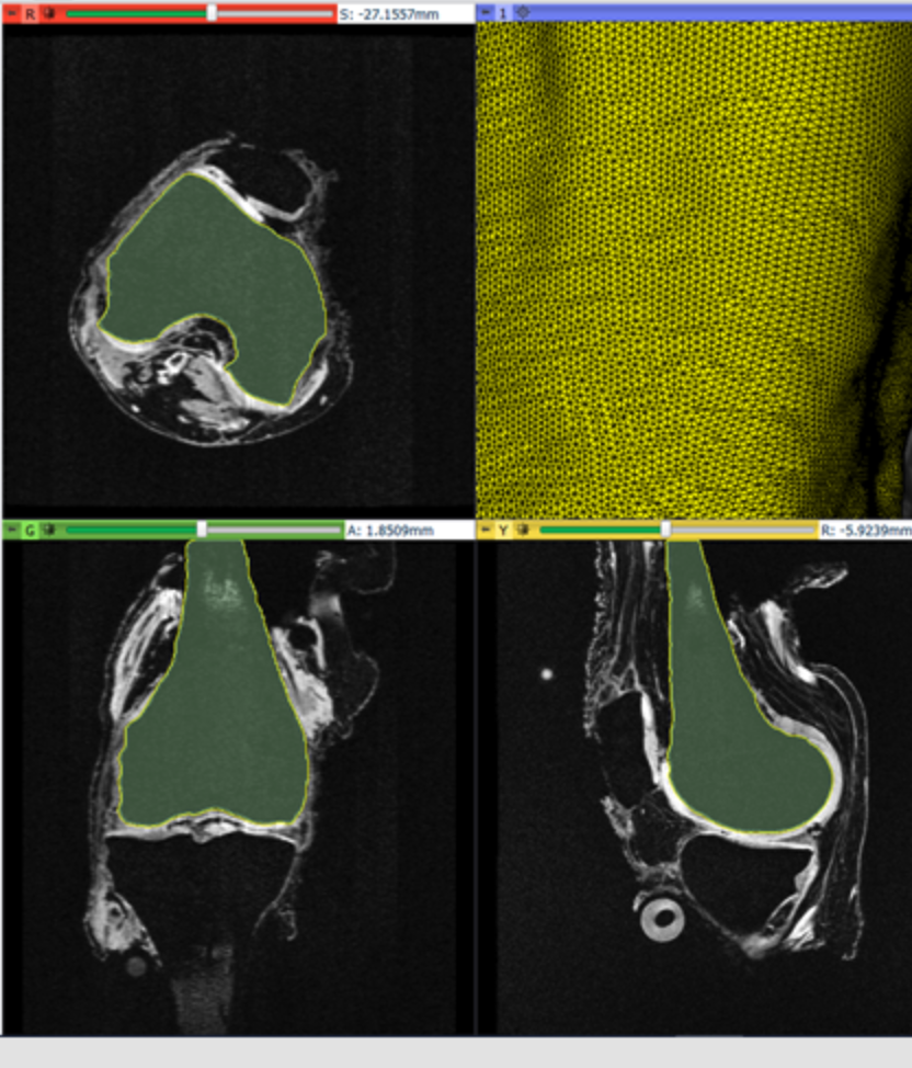 4 scans of the human body