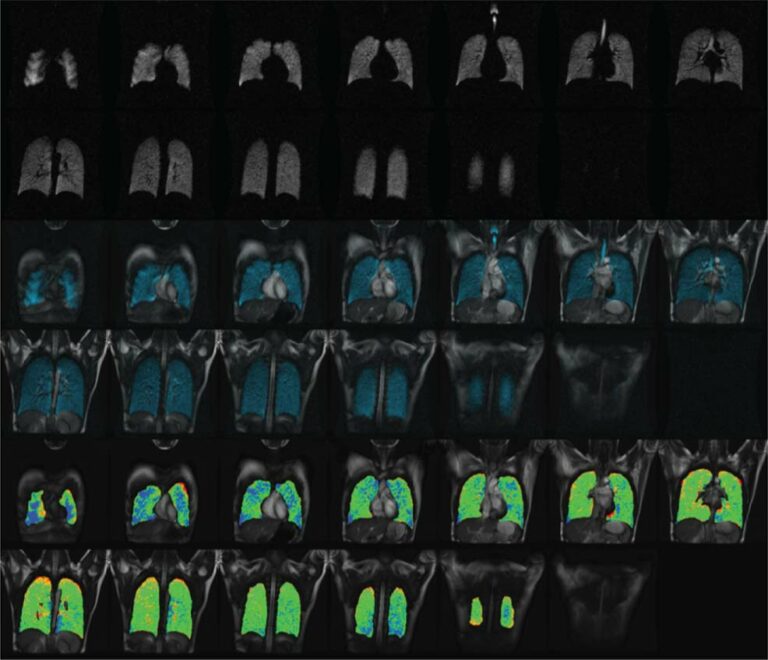 Several images of a chest cavity