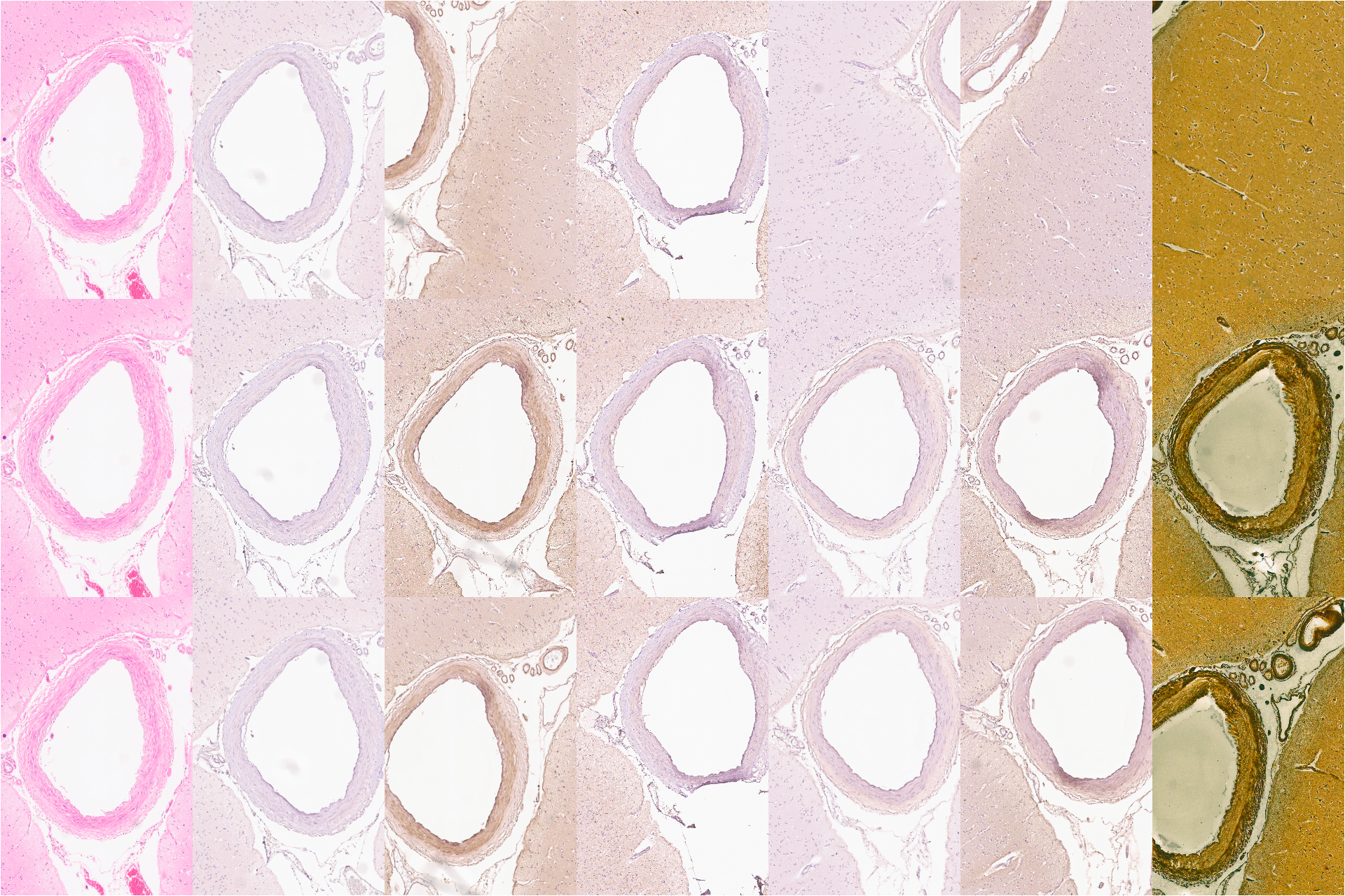 Comparison of unaligned, TPS aligned, and affine transform aligned serial sections with different stains