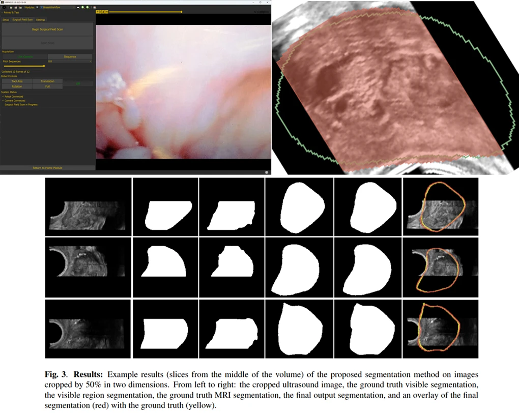 Medical imaging analysis interface showing a software application window with an endoscopic view on the top left, a highlighted ultrasound image on the top right, and a bottom grid titled "Fig. 3. Results" containing three rows of cross-sectional scans demonstrating image segmentation steps (ultrasound, visible segmentation, MRI segmentation, output segmentation, and final overlaid contours).