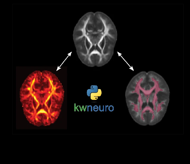 kwneuro wording with python logo and 3 scans of brains
