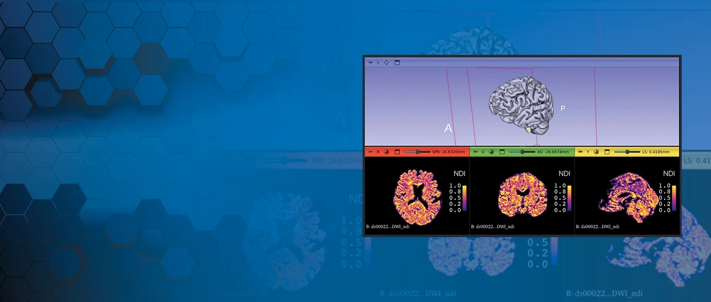 A website hero banner featuring a 3D Slicer window with brain MRI visualizations and NDI color maps on the right, set against a dark blue background with 3D hexagon patterns.