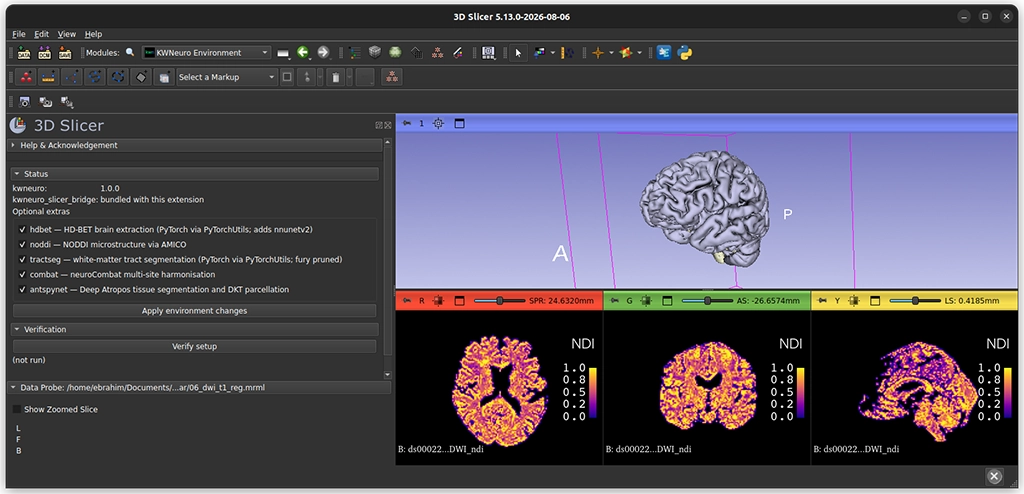 A 3D Slicer software interface showing the KWNeuro extension panel alongside 3D and 2D brain MRI cross-section visualizations showing Neurite Density Index (NDI) maps.