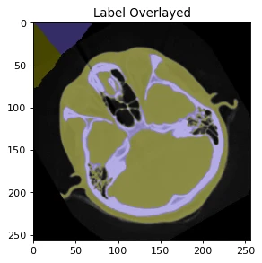 An axial CT medical image slice labeled "Label Overlayed" displaying color-coded segmentation masks over cranial structures